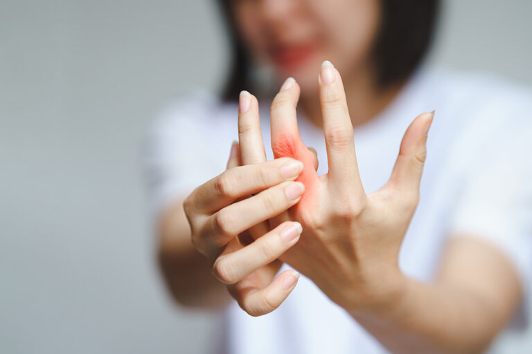 What Are The 4 Stages Of Rheumatoid Arthritis | ArthritisCARE